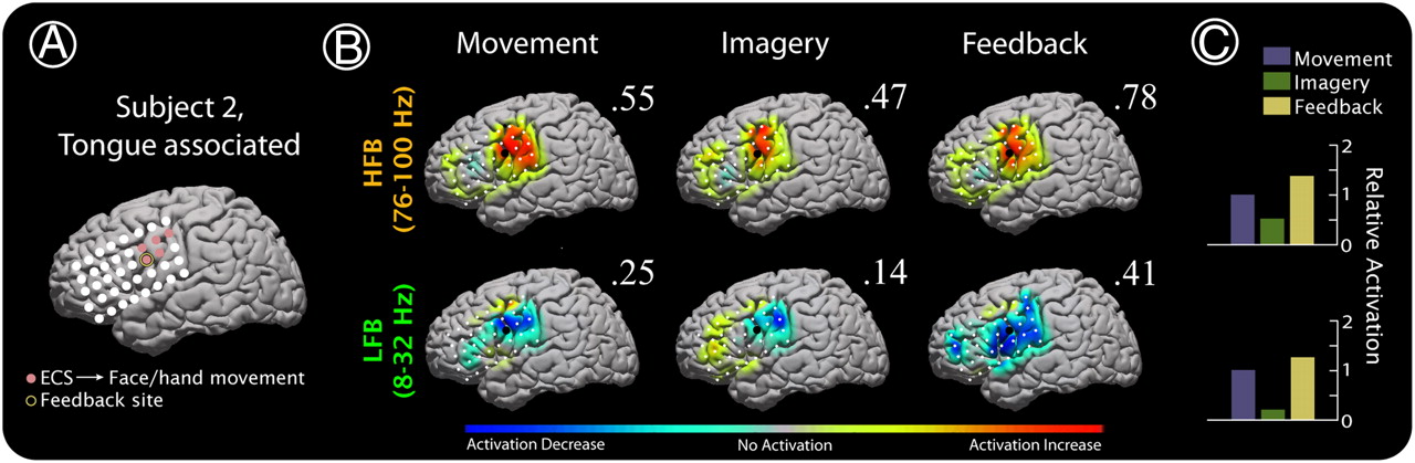 Brain scan comparing motor activation and motor imagery